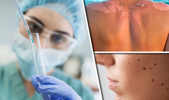 Skin-cancer-A-drug-breakthrough-could-pave-the-way-for-new-melanoma-treatments-750991.jpg