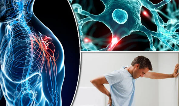 esclerosis múltiple