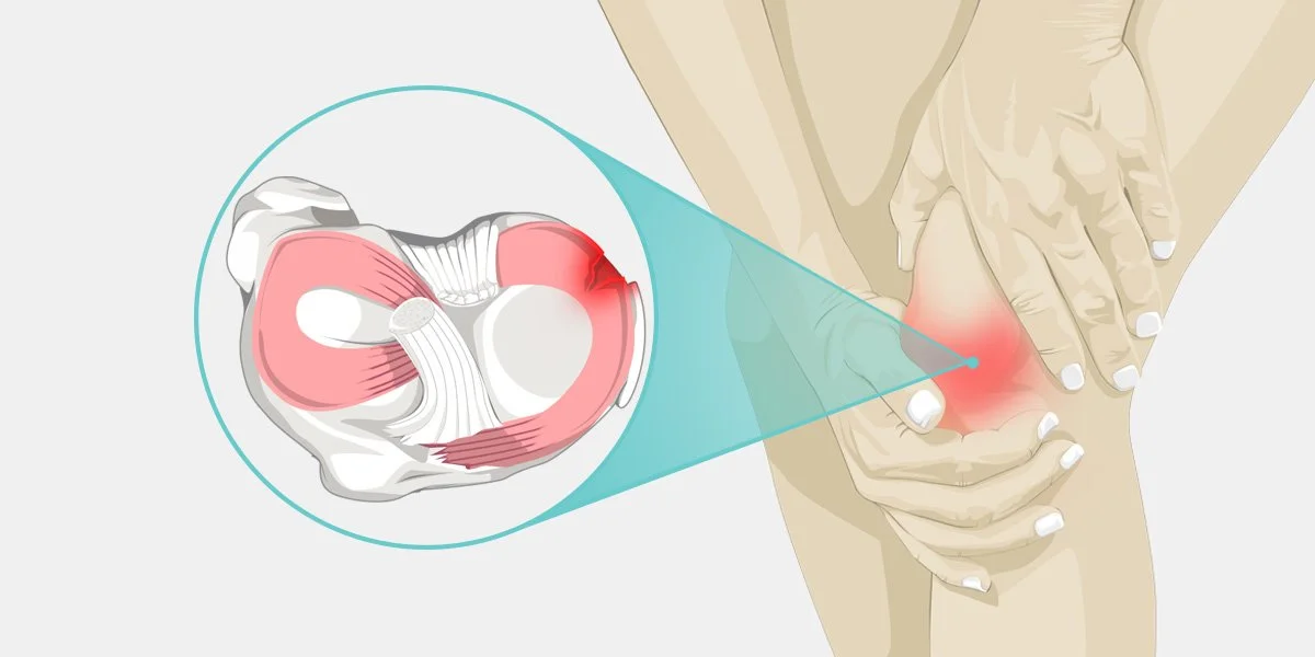 Meniscus