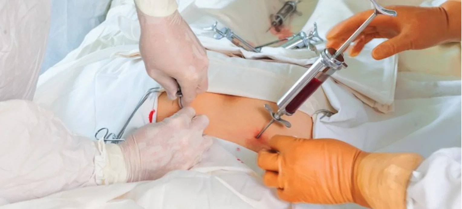 stem cell transplant