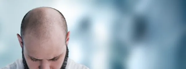 Alopecia treatment